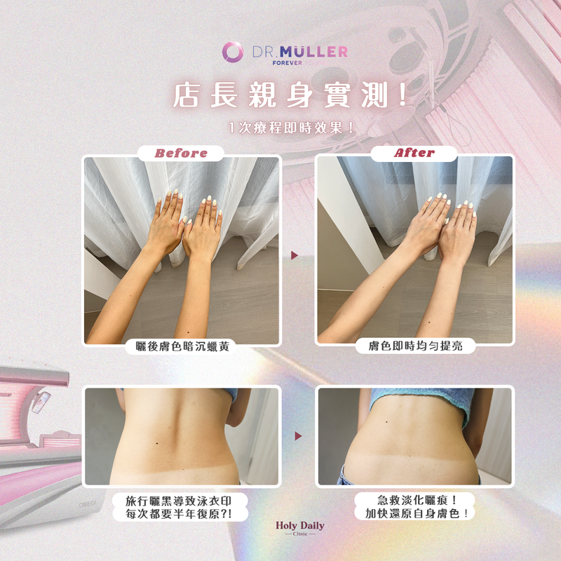 DR.MULLER Omega 荷蘭高端膠原鑽白艙