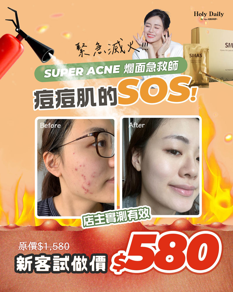 \ 新客限定 /SUPER ACNE 爛面急救師