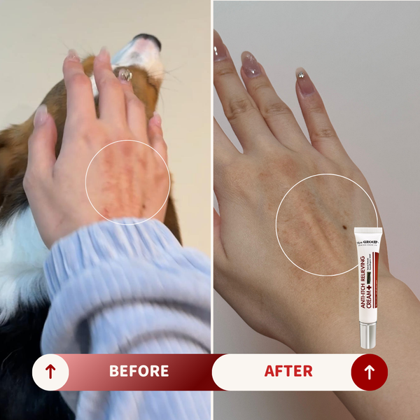 【預訂】特效治療濕疹膏