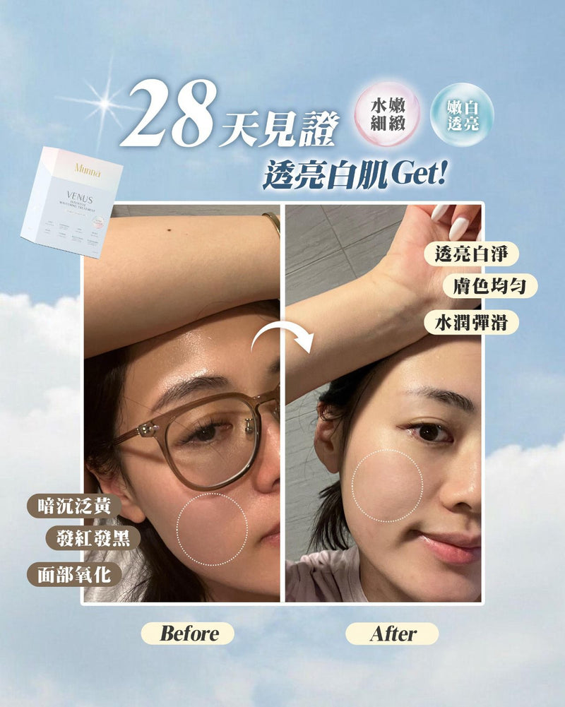 雙11狂歡 極緻美白套裝 $1111