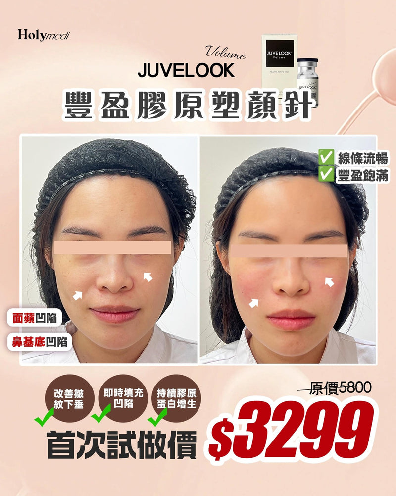 \新客首次試做價/ Juvelook Volume 豐盈膠原塑顏療程 (小黑瓶)