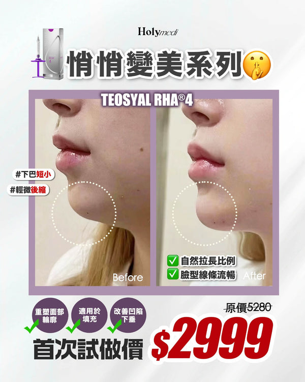 \新客首次試做價/ TEOSYAL RHA®4 透明質酸