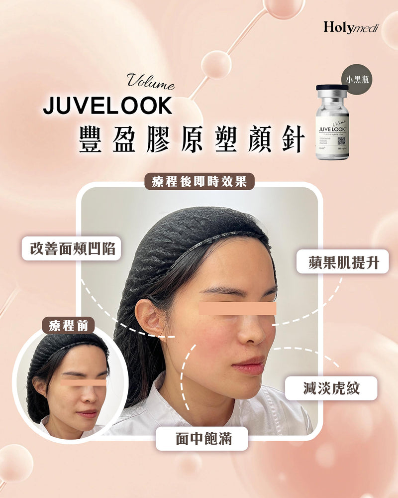 【醫生主理】Juvelook Volume 豐盈膠原塑顏針 (小黑瓶)