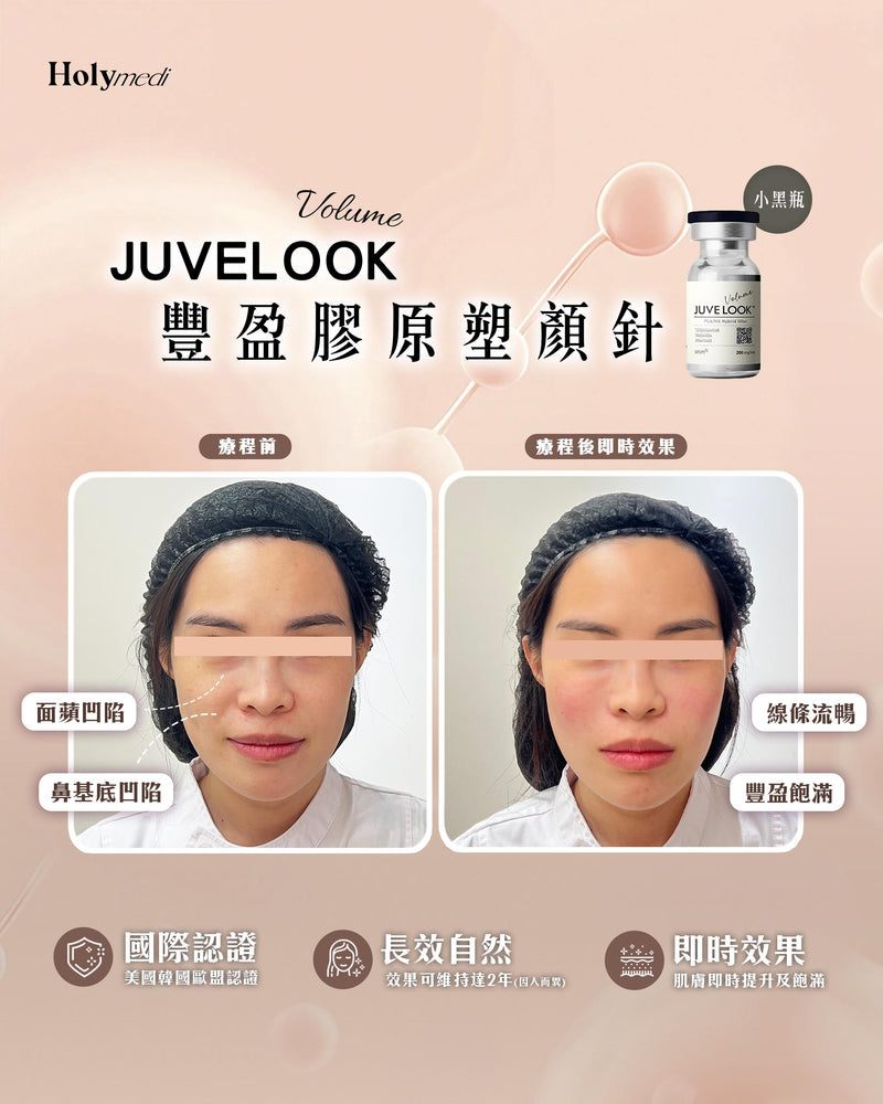 【醫生主理】Juvelook Volume 豐盈膠原塑顏針 (小黑瓶)